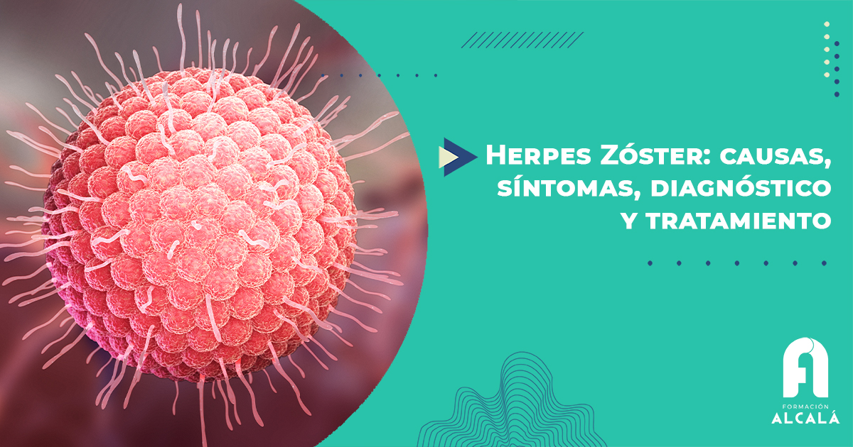 Imagen de Herpes Zóster: causas, síntomas, diagnóstico y tratamiento